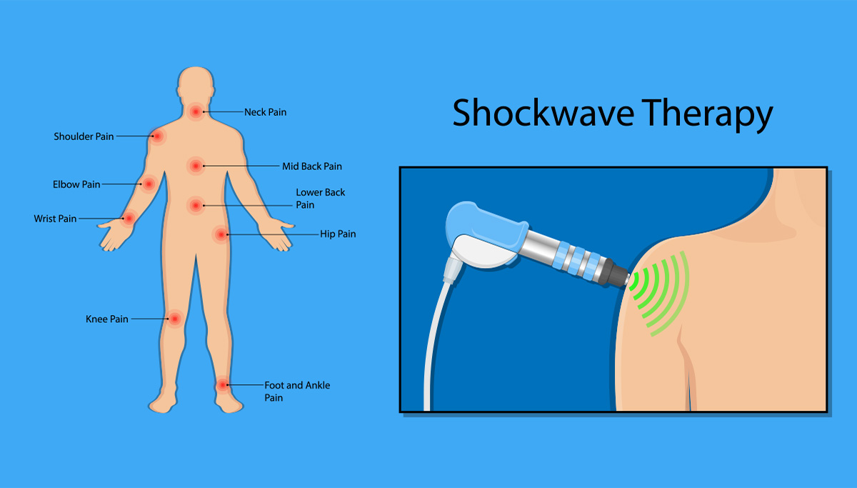 shockwave image 1200 x 683